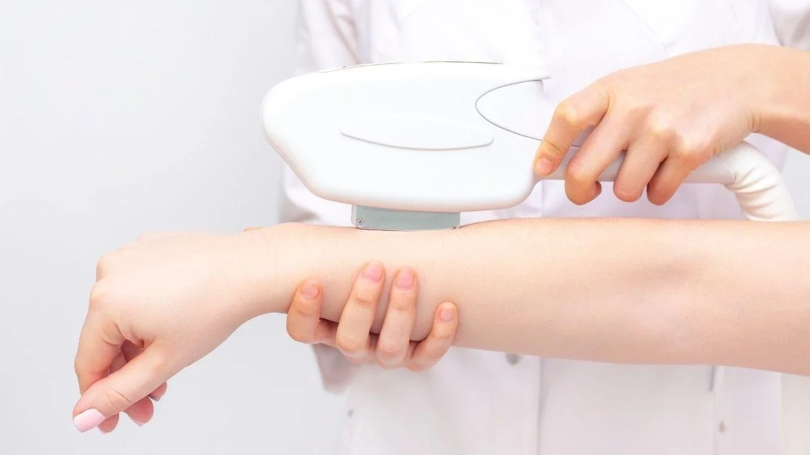 Depilacja laserowa rąk w Warszawie - Gładkość bez kompromisów!